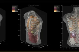 AI Startup Midjourney Pivots to Health With Ultras...